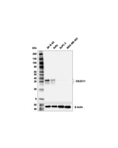 Cell Signaling COLEC11 (E9F9S) Rabbit mAb; 20 µl