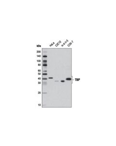 Cell Signaling Tbp Antibody