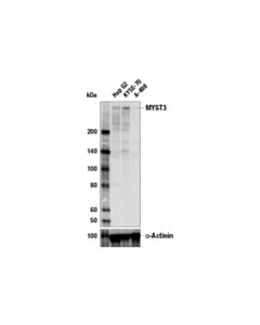 Cell Signaling Myst3 (E3p5t) Rabbit mAb