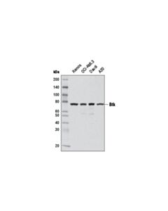 Cell Signaling Btk (D3h5) Rabbit mAb