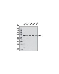 Cell Signaling Atg7 (D12b11) Rabbit mAb