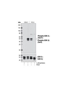 Cell Signaling Phospho-GSK-3alpha/beta (Ser21/9) (D17D2) Rabbit mAb 20 uL
