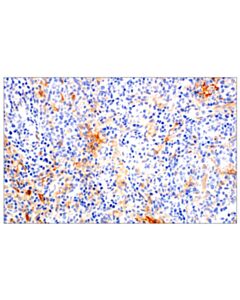 Cell Signaling Il-13ra2/Cd213a2 (E7u7b) Rabbit mAb