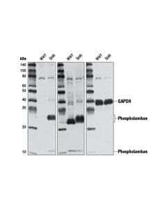 Cell Signaling Calcium Ion Regulation Antibody Sampler Kit