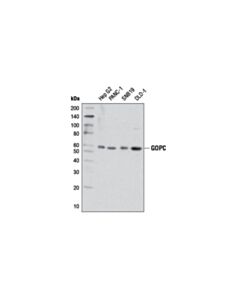 Cell Signaling Gopc (D10a12) Rabbit mAb