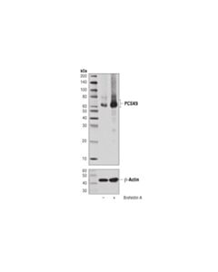 Cell Signaling Pcsk9 (D7u6l) Rabbit mAb
