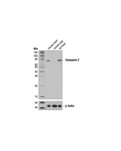 Cell Signaling Synapsin-2 (D6s9c) Rabbit mAb