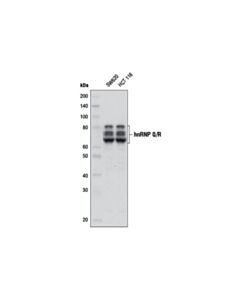 Cell Signaling hnRNP Q/R (D18B2) Rabbit mAb 20 uL