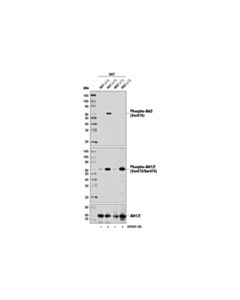 Cell Signaling Phospho-Akt2 (Ser474) (D3H2) Rabbit mAb 20 uL