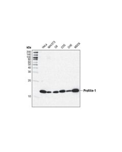 Cell Signaling Actin Nucleation And Polymerization Antibody Sampler Kit