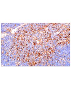 Cell Signaling beta2-microglobulin (F4S6H) Rabbit mAb