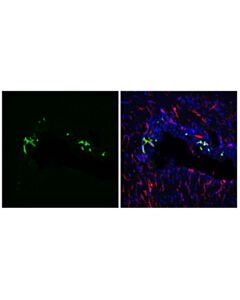Cell Signaling MHC Class II (I-A/I-E) (M5/114.15.2) Rat mAb