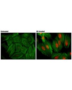 Cell Signaling Phospho-P38 Mapk (Thr180/Tyr182) (D3f9) Xp Rabbit mAb (Alexa Fluor 594 Conjugate)