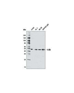 Cell Signaling IkappaBbeta (7B4) Mouse mAb 20 uL