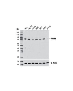 Cell Signaling Rrm1 (D12f12) Xp Rabbit mAb