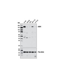 Cell Signaling ASK1 (D11C9) Rabbit mAb 20 uL