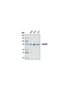 Cell Signaling Tight Junction Antibody Sampler Kit