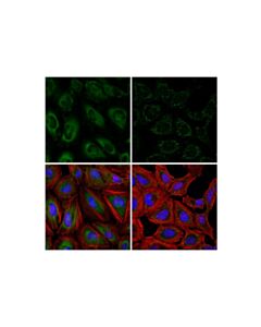 Cell Signaling G3BP2 (F3Y7Z) Mouse mAb