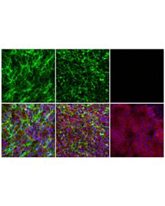 Cell Signaling Col5a1 (E6u9w) Rabbit mAb