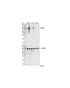 Cell Signaling Mdm2 (D1v2z) Rabbit mAb