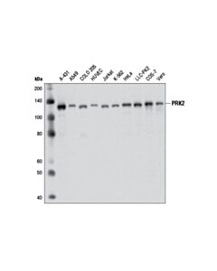 Cell Signaling PRK2 (D10A10) Rabbit mAb 20 uL
