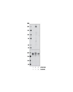 Cell Signaling Sorafenib