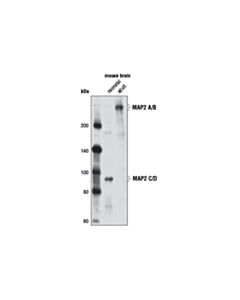 Cell Signaling Map2 (D5g1) Xp Rabbit mAb