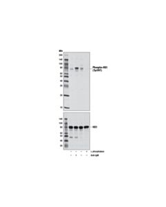 Cell Signaling Phospho-HS1 (Tyr397) (D12C1) XP Rabbit mAb
