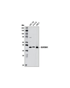 Cell Signaling Suv39h1 (D11b6) Rabbit mAb