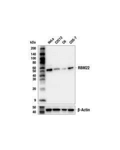Cell Signaling RBM22 (E9E6Z) Rabbit mAb