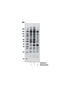 Cell Signaling Phospho-Ck2 Substrate [(PS/Pt)Dxe] Multimab Rabbit mAb Mix