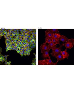 Cell Signaling Met (L6E7) Mouse mAb 20 uL