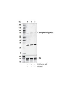 Cell Signaling Phospho-Btk (Tyr223) (D1d2z) Rabbit mAb