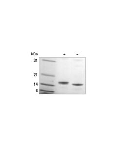 Cell Signaling Human Il-16 Recombinant Protein