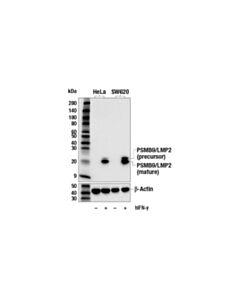 Cell Signaling PSMB9/LMP2 (E7J1L) Rabbit mAb 20 uL