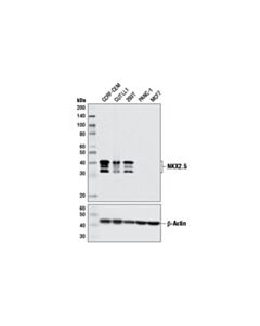 Cell Signaling Nkx2.5 (E1y8h) Rabbit mAb