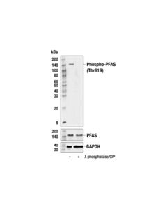 Cell Signaling Phospho-Pfas (Thr619) Antibody