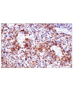 Cell Signaling Cd23 (E1r4g) Rabbit mAb