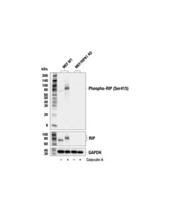 Cell Signaling Phospho-RIP (Ser415) Antibody