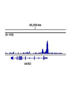 Cell Signaling Non-Phospho (Active) Beta-Catenin (Ser33/37/Thr41) (D13a1) Rabbit mAb