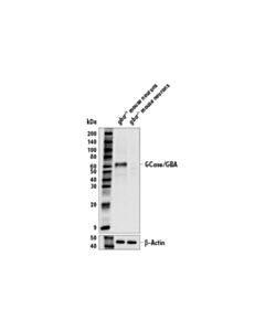 Cell Signaling GCase/GBA (E2R1L) Rabbit mAb 20 uL
