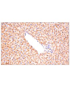 Cell Signaling Cathepsin D (E7z4l) Xp Rabbit mAb