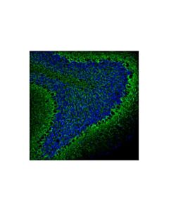 Cell Signaling Neurofilament-L (C28E10) Feline Chimeric mAb