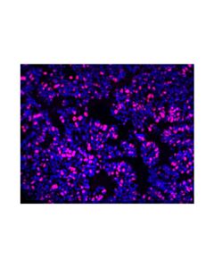 Cell Signaling Ki-67 (D2h10) Rabbit mAb (Alexa Fluor ® 555 Conjugate)