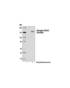 Cell Signaling Phospho-Tacc3 (Ser558) (D8h10) Xp Rabbit mAb