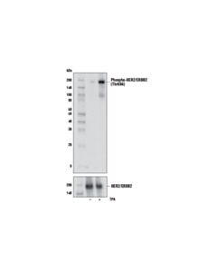 Cell Signaling Phospho-Her2/Erbb2 (Thr686) Antibody