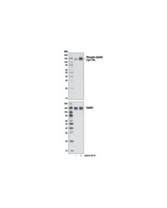 Cell Signaling Phospho-EphA3 (Tyr779) (D10H1) Rabbit mAb 20 uL
