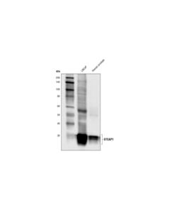 Cell Signaling Steap1 (D8b2v) Rabbit mAb