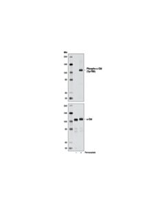 Cell Signaling Phospho-C-Cbl (Tyr700) (D16d7) Rabbit mAb