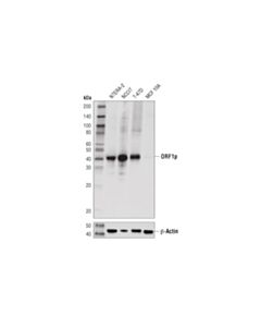 Cell Signaling ORF1p (D3W9O) Rabbit mAb 20 uL